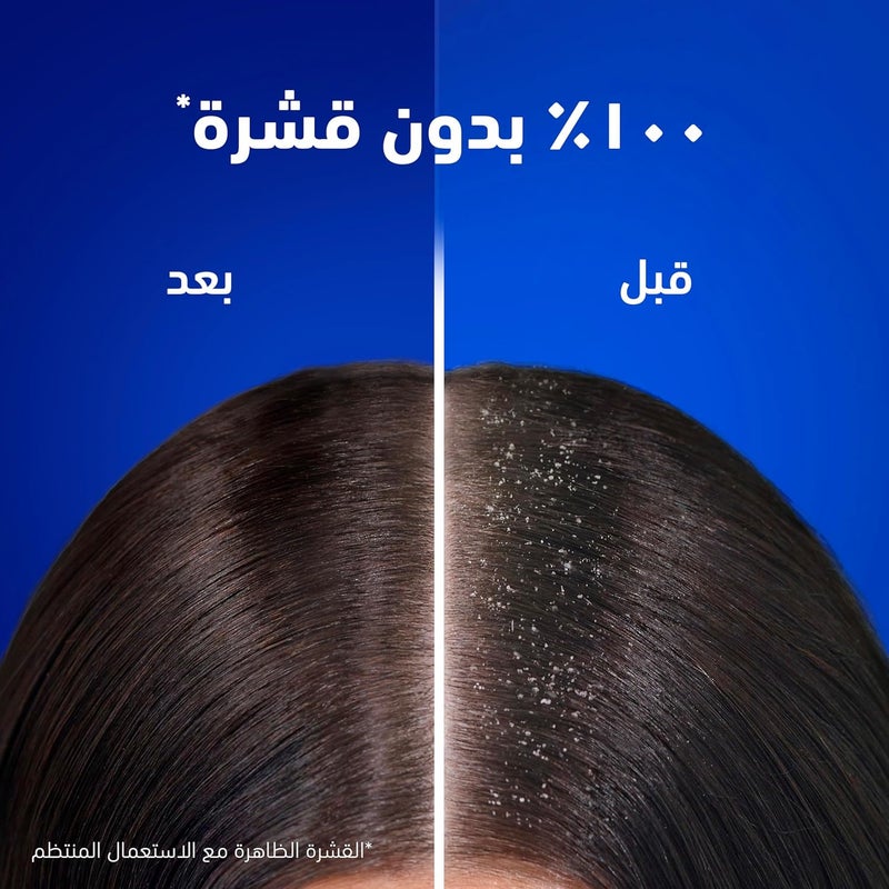 بلسم هيد آند شولدرز كلاسيك كلين 360 مل - Image 2